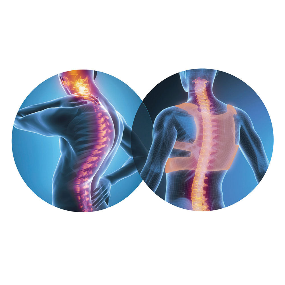 Backgym Haltungskorrektor Trainer - Für eine bessere Körperhaltung und Rückengesundheit für den Alltag SeronaShop